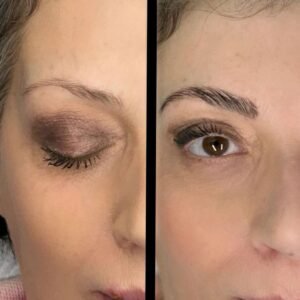 BIOSTIMOLAZIONE SOPRACCIGLIA2.jpeg